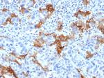 TACSTD2/TROP2 Recombinant Rabbit Monoclonal Antibody (TACSTD2, 6394R)