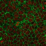 EpCAM/CD326 (Epithelial Marker) Antibody in Immunocytochemistry (ICC/IF)