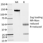 EpCAM/CD326 (Epithelial Marker) Antibody in SDS-PAGE (SDS-PAGE)