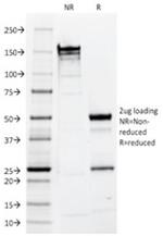 Ep-CAM/CD326 Antibody in SDS-PAGE (SDS-PAGE)