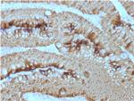 Ep-CAM/CD326 (Extracellular Domain) (Epithelial Marker) Antibody in Immunohistochemistry (Paraffin) (IHC (P))