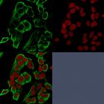 EpCAM/CD326 (Epithelial Marker) Antibody in Immunocytochemistry (ICC/IF)