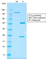 EpCAM/CD326 (Epithelial Marker) Antibody in SDS-PAGE (SDS-PAGE)