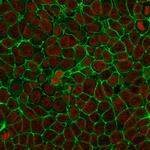 Ep-CAM/CD326 (Extracellular Domain) (Epithelial Marker) Antibody in Immunocytochemistry (ICC/IF)
