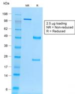 Ep-CAM/CD326 (Extracellular Domain) (Epithelial Marker) Antibody in SDS-PAGE (SDS-PAGE)