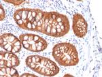 Ep-CAM/CD326 (Extracellular Domain) (Epithelial Marker) Antibody in Immunohistochemistry (Paraffin) (IHC (P))