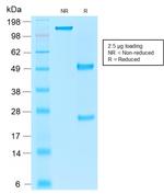 Ep-CAM/CD326 Antibody in SDS-PAGE (SDS-PAGE)