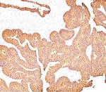 EpCAM/CD326 (Epithelial Marker) Antibody in Immunohistochemistry (Paraffin) (IHC (P))