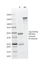 EpCAM/CD326 (Epithelial Marker) Antibody in SDS-PAGE (SDS-PAGE)