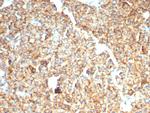 EpCAM/CD326 (Epithelial Marker) Antibody in Immunohistochemistry (Paraffin) (IHC (P))