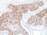 Ep-CAM/CD326 (Extracellular Domain) (Epithelial Marker) Antibody in Immunohistochemistry (Paraffin) (IHC (P))