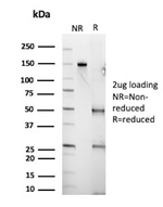 Ep-CAM/CD326 (Extracellular Domain) (Epithelial Marker) Antibody in SDS-PAGE (SDS-PAGE)