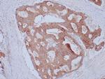 Ep-CAM/CD326 (Extracellular Domain) (Epithelial Marker) Antibody in Immunohistochemistry (Paraffin) (IHC (P))