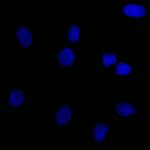 Ep-CAM/CD326 (Extracellular Domain) (Epithelial Marker) Antibody in Immunocytochemistry (ICC/IF)