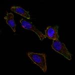 Ep-CAM/CD326 (Extracellular Domain) (Epithelial Marker) Monoclonal Antibody (EGP40/826)