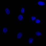 Ep-CAM/CD326 (Extracellular Domain) (Epithelial Marker) Antibody in Immunocytochemistry (ICC/IF)