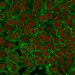 Ep-CAM/CD326 Monoclonal Antibody (EGP40, 837)