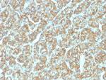 EpCAM/CD326 (Epithelial Marker) Antibody in Immunohistochemistry (Paraffin) (IHC (P))