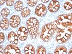 EpCAM/CD326 (Epithelial Marker) Antibody in Immunohistochemistry (Paraffin) (IHC (P))