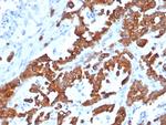 EpCAM/CD326 (Epithelial Marker) Antibody in Immunohistochemistry (Paraffin) (IHC (P))