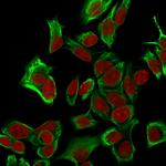 EpCAM/CD326 (Epithelial Marker) Recombinant Rabbit Monoclonal Antibody (EGP40/1555R)