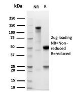 EpCAM/CD326 (Epithelial Marker) Antibody in SDS-PAGE (SDS-PAGE)