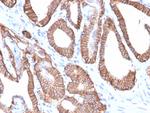 Ep-CAM/CD326 (Extracellular Domain) (Epithelial Marker) Antibody in Immunohistochemistry (Paraffin) (IHC (P))