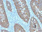 Ep-CAM/CD326 (Extracellular Domain) (Epithelial Marker) Antibody in Immunohistochemistry (Paraffin) (IHC (P))