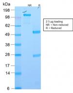 Ep-CAM/CD326 (Extracellular Domain) (Epithelial Marker) Antibody in SDS-PAGE (SDS-PAGE)