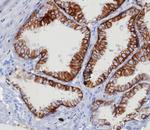 EpCAM/CD326 (Epithelial Marker) Antibody in Immunohistochemistry (Paraffin) (IHC (P))