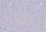 EpCAM/CD326 (Epithelial Marker) Antibody in Immunohistochemistry (Paraffin) (IHC (P))