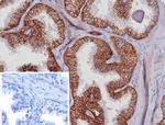 EpCAM/CD326 (Epithelial Marker) Antibody in Immunohistochemistry (Paraffin) (IHC (P))