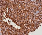 EpCAM/CD326 (Epithelial Marker) Antibody in Immunohistochemistry (Paraffin) (IHC (P))