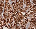 EpCAM/CD326 (Epithelial Marker) Antibody in Immunohistochemistry (Paraffin) (IHC (P))