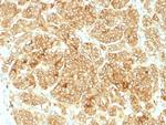 EpCAM/CD326 (Epithelial Marker) Antibody in Immunohistochemistry (Paraffin) (IHC (P))
