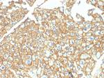 EpCAM/CD326 (Epithelial Marker) Antibody in Immunohistochemistry (Paraffin) (IHC (P))