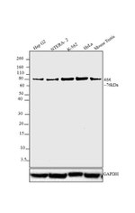 ASK Antibody in Western Blot (WB)