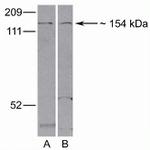 LRP8 Antibody in Western Blot (WB)