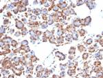 SMAD4/DPC4 (Pancreatic Adenocarcinoma Marker/Tumor Suppressor) Recombinant Rabbit Monoclonal Antibody (SMAD/7905R)