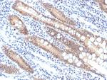 SMAD4/DPC4 (Pancreatic Adenocarcinoma Marker/Tumor Suppressor) Recombinant Rabbit Monoclonal Antibody (SMAD/7906R)