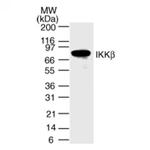IKK beta Antibody in Western Blot (WB)