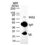 IKK beta Antibody in Western Blot (WB)