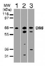 DR6 Antibody in Western Blot (WB)