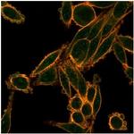 SMAD9 Monoclonal Antibody (PCRP-SMAD9-2F4)