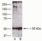 CDw293 Antibody in Western Blot (WB)