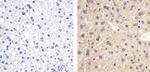 ANGPTL4 Polyclonal Antibody