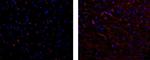 Mouse IgG1 kappa Isotype Control in Immunohistochemistry (Paraffin) (IHC (P))