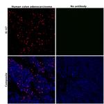 Ki-67 Antibody in Immunohistochemistry (Paraffin) (IHC (P))