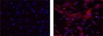 APP (Amyloid Precursor Protein) Monoclonal Antibody (22C11), eFluor™ 570, eBioscience™