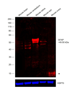 GFAP Antibody in Western Blot (WB)